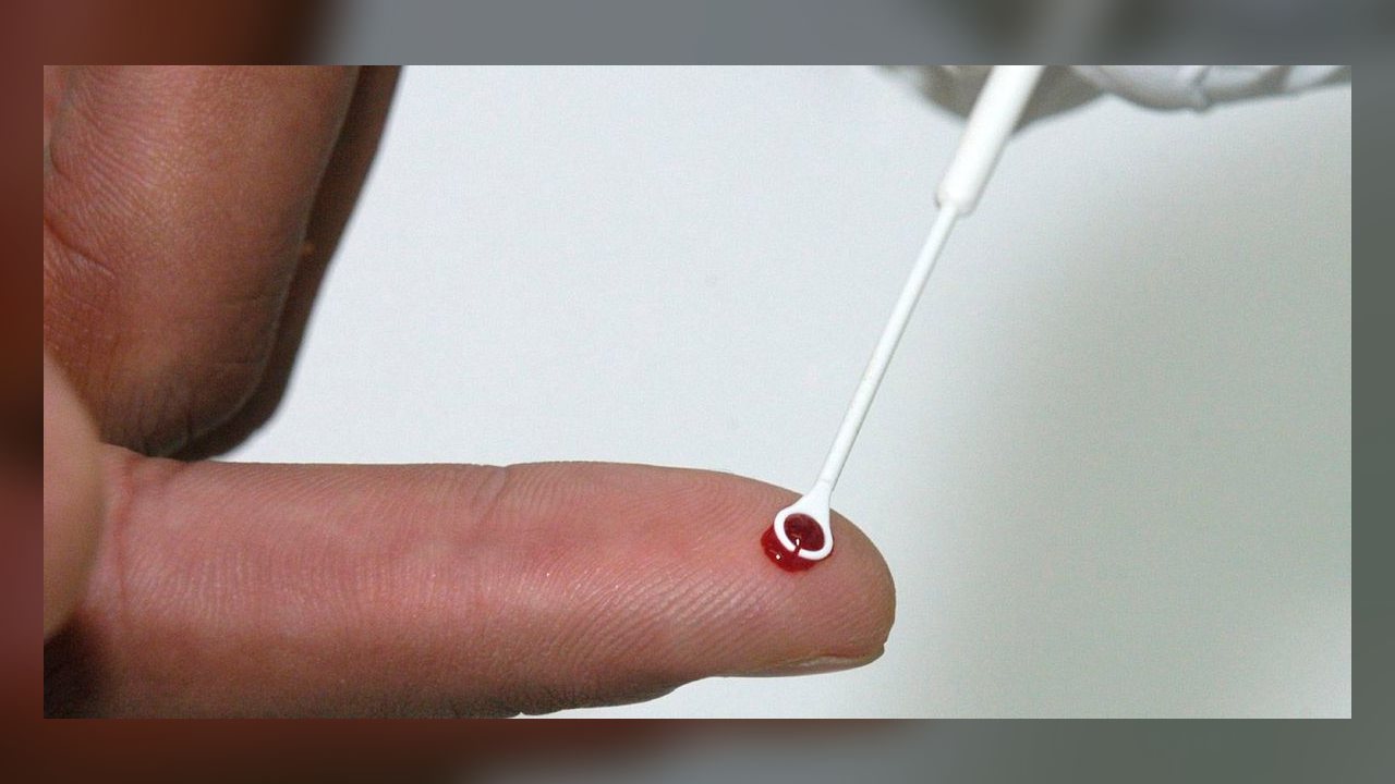 Fiji decreta emergência nacional após explosão de casos de HIV no arquipélago